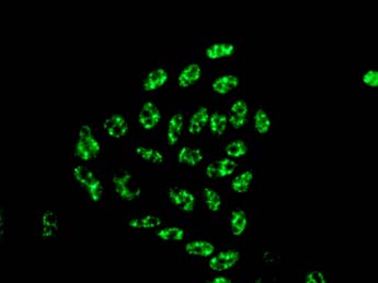 Immunocytochemistry/ Immunofluorescence - Anti-PRP16 antibody [EPR9845] (AB154801)