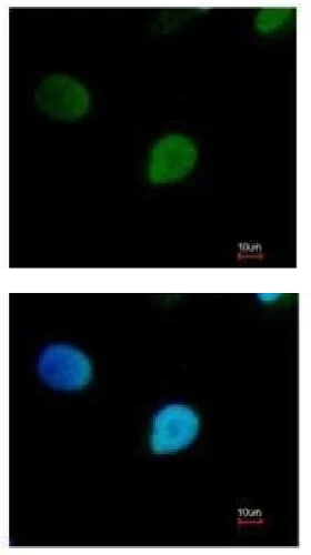 Immunocytochemistry/ Immunofluorescence - Anti-PRP19 antibody (AB228694)