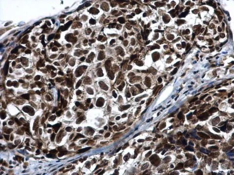 Immunohistochemistry (Formalin/PFA-fixed paraffin-embedded sections) - Anti-PRP19 antibody (AB228694)