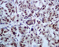 Immunohistochemistry (Formalin/PFA-fixed paraffin-embedded sections) - Anti-PRP19 antibody [EPR7446] - BSA and Azide free (AB248181), expandable thumbnail