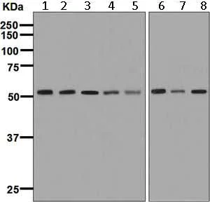 Western blot - Anti-PRP19 antibody [EPR7446] - BSA and Azide free (AB248181)