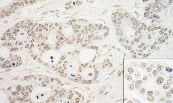 Immunohistochemistry (Formalin/PFA-fixed paraffin-embedded sections) - Anti-PRP6/ANT-1 antibody (AB99292), expandable thumbnail