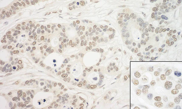 Immunohistochemistry (Formalin/PFA-fixed paraffin-embedded sections) - Anti-PRP6/ANT-1 antibody (AB99292)