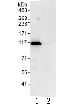 Immunoprecipitation - Anti-PRP6/ANT-1 antibody (AB99292), expandable thumbnail