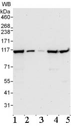 Western blot - Anti-PRP6/ANT-1 antibody (AB99292), expandable thumbnail