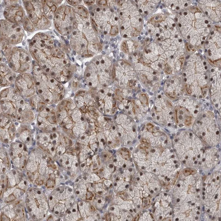 Immunohistochemistry (Formalin/PFA-fixed paraffin-embedded sections) - Anti-PRPF3 antibody (AB272596)