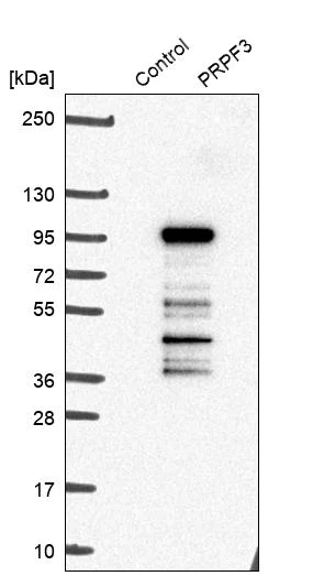 Western blot - Anti-PRPF3 antibody (AB272596)
