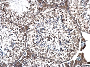 Immunohistochemistry (Formalin/PFA-fixed paraffin-embedded sections) - Anti-PRPF31 antibody (AB184127)