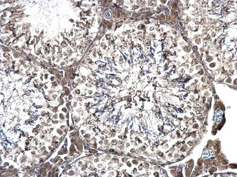 Immunohistochemistry (Formalin/PFA-fixed paraffin-embedded sections) - Anti-PRPF31 antibody (AB184127)