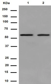 Western blot - Anti-PRPF31 antibody [EPR14587] (AB188577)
