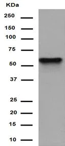 Western blot - Anti-PRPF31 antibody [EPR14587] - BSA and Azide free (AB250970)