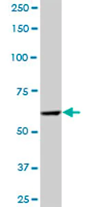 Western blot - Anti-PRPF4 antibody (AB69878)