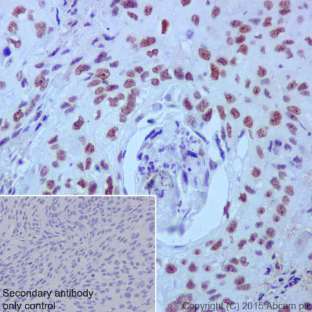 Immunohistochemistry (Formalin/PFA-fixed paraffin-embedded sections) - Anti-PRPF4 antibody [EPR17206(B)] (AB201684)