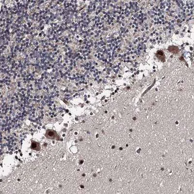 Immunohistochemistry (Formalin/PFA-fixed paraffin-embedded sections) - Anti-PRPF40B antibody (AB122474)
