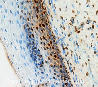 Immunohistochemistry (Formalin/PFA-fixed paraffin-embedded sections) - Anti-PRPF8/Prp8 antibody [2834C1a] (AB51366), expandable thumbnail