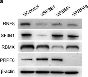 Western blot - Anti-PRPF8/Prp8 antibody [2834C1a] (AB51366)