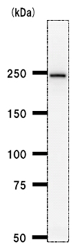 Western blot - Anti-PRPF8/Prp8 antibody [2834C1a] (AB51366), expandable thumbnail