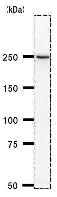 Western blot - Anti-PRPF8/Prp8 antibody [2834C1a] (AB51366)