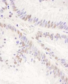 Immunohistochemistry (Formalin/PFA-fixed paraffin-embedded sections) - Anti-PRPF8/Prp8 antibody (AB245504), expandable thumbnail