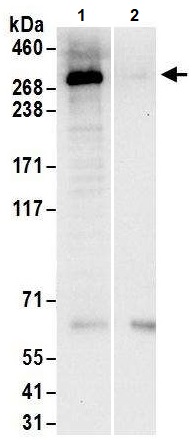 Immunoprecipitation - Anti-PRPF8/Prp8 antibody (AB245504), expandable thumbnail