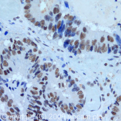 Immunohistochemistry (Formalin/PFA-fixed paraffin-embedded sections) - Anti-PRPF8/Prp8 antibody (AB79237), expandable thumbnail