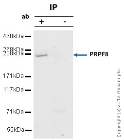 Immunoprecipitation - Anti-PRPF8/Prp8 antibody (AB79237), expandable thumbnail