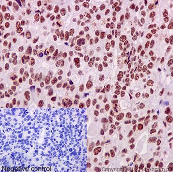 Immunohistochemistry (Formalin/PFA-fixed paraffin-embedded sections) - Anti-PRPF8/Prp8 antibody [EPR15228] (AB190347), expandable thumbnail