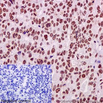 Immunohistochemistry (Formalin/PFA-fixed paraffin-embedded sections) - Anti-PRPF8/Prp8 antibody [EPR15228] (AB190347)
