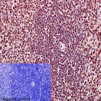 Immunohistochemistry (Formalin/PFA-fixed paraffin-embedded sections) - Anti-PRPF8/Prp8 antibody [EPR15228] (AB190347), expandable thumbnail