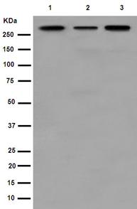 Western blot - Anti-PRPF8/Prp8 antibody [EPR15228] (AB190347), expandable thumbnail