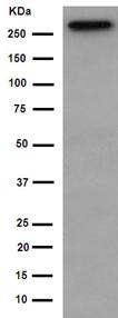 Western blot - Anti-PRPF8/Prp8 antibody [EPR15228] (AB190347), expandable thumbnail