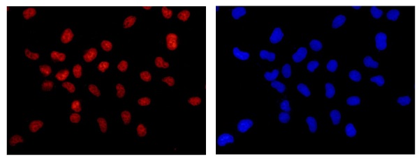 Immunocytochemistry/ Immunofluorescence - Anti-PRPF8/Prp8 antibody [EPR15229] - C-terminal (ab185547), expandable thumbnail