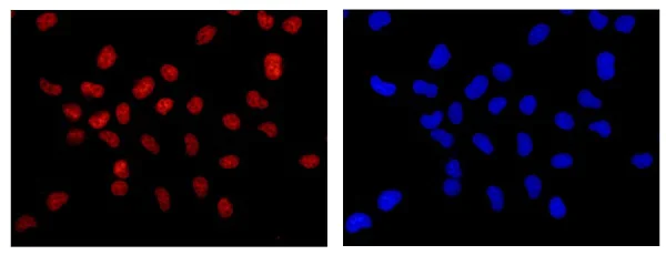 Immunocytochemistry/ Immunofluorescence - Anti-PRPF8/Prp8 antibody [EPR15229] - C-terminal (AB185547)