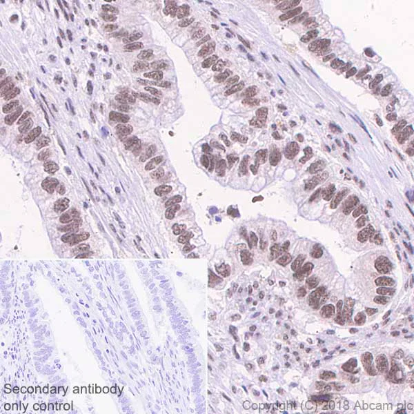 Immunohistochemistry (Formalin/PFA-fixed paraffin-embedded sections) - Anti-PRPF8/Prp8 antibody [EPR15229] - C-terminal (AB185547)