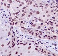 Immunohistochemistry (Formalin/PFA-fixed paraffin-embedded sections) - Anti-PRPF8/Prp8 antibody [EPR15229] - C-terminal (ab185547), expandable thumbnail