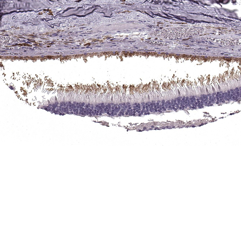 Immunohistochemistry (Formalin/PFA-fixed paraffin-embedded sections) - Anti-PRPH2/RDS antibody (AB122057)