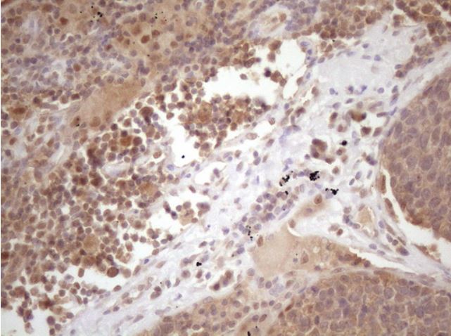 Immunohistochemistry (Formalin/PFA-fixed paraffin-embedded sections) - Anti-PRPK antibody [OTI5B2] (AB279377)