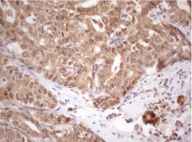 Immunohistochemistry (Formalin/PFA-fixed paraffin-embedded sections) - Anti-PRPK antibody [OTI5B2] (AB279377)