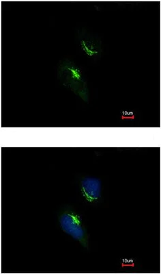 Immunocytochemistry/ Immunofluorescence - Anti-PRPS1 antibody (AB137577)