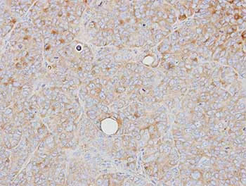 Immunohistochemistry (Formalin/PFA-fixed paraffin-embedded sections) - Anti-PRPS1 antibody (AB137577)