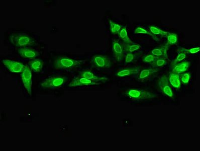 Immunocytochemistry/ Immunofluorescence - Anti-PRPS2 antibody (AB234886)