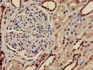 Immunohistochemistry (Formalin/PFA-fixed paraffin-embedded sections) - Anti-PRPS2 antibody (AB234886)