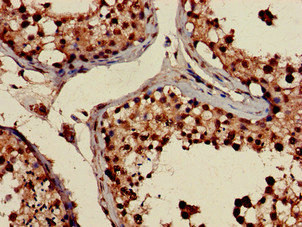 Immunohistochemistry (Formalin/PFA-fixed paraffin-embedded sections) - Anti-PRPS2 antibody (AB234886)