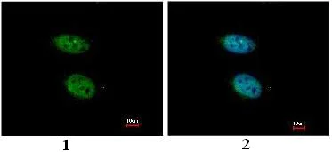 Immunocytochemistry/ Immunofluorescence - Anti-PRPS2 antibody (AB96222)