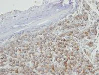 Immunohistochemistry (Formalin/PFA-fixed paraffin-embedded sections) - Anti-PRPS2 antibody (AB96222)