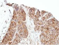 Immunohistochemistry (Formalin/PFA-fixed paraffin-embedded sections) - Anti-PRPSAP1 antibody (AB97561)