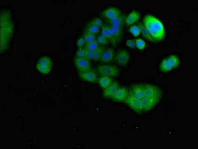 Immunocytochemistry/ Immunofluorescence - Anti-PRR11 antibody (AB237526)