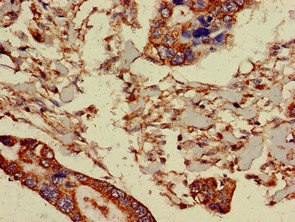 Immunohistochemistry (Formalin/PFA-fixed paraffin-embedded sections) - Anti-PRR11 antibody (AB237526)