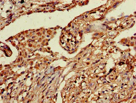 Immunohistochemistry (Formalin/PFA-fixed paraffin-embedded sections) - Anti-PRR11 antibody (AB237526)