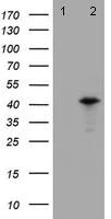 Western blot - Anti-PRR11 antibody [OTI1A4] (AB131652)
